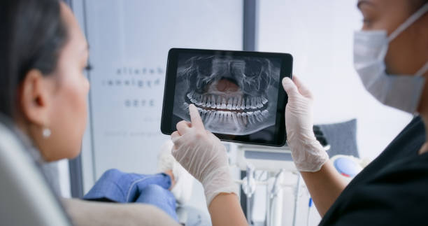 Licensed Teeth Whitening service in Rendon, TX - Smile Center Dentistry